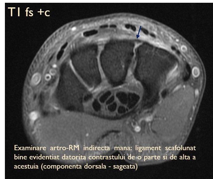 Medicina regenerativa a cartilajului | e-petshop.ro, Pregătire complexă pentru articulații
